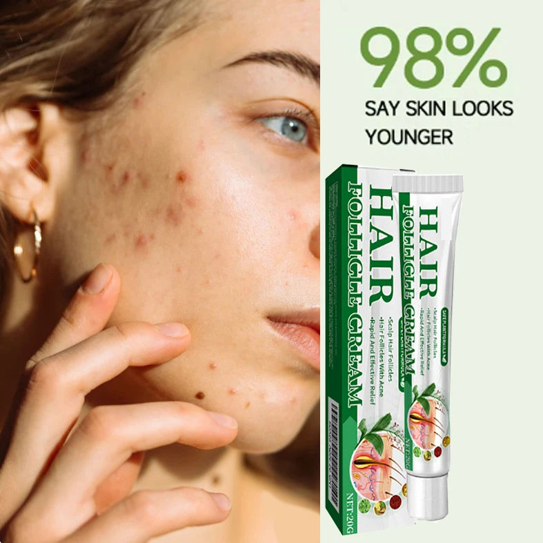 3RD Anti-Acne Essence Cream