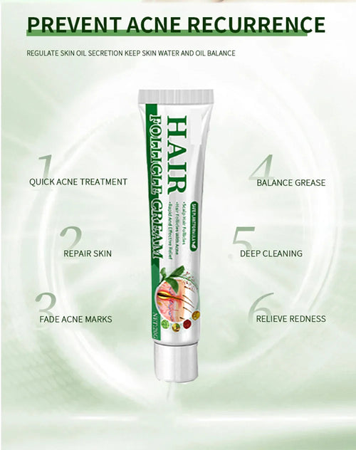 3RD Anti-Acne Essence Cream