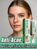 3RD Anti-Acne Essence Cream