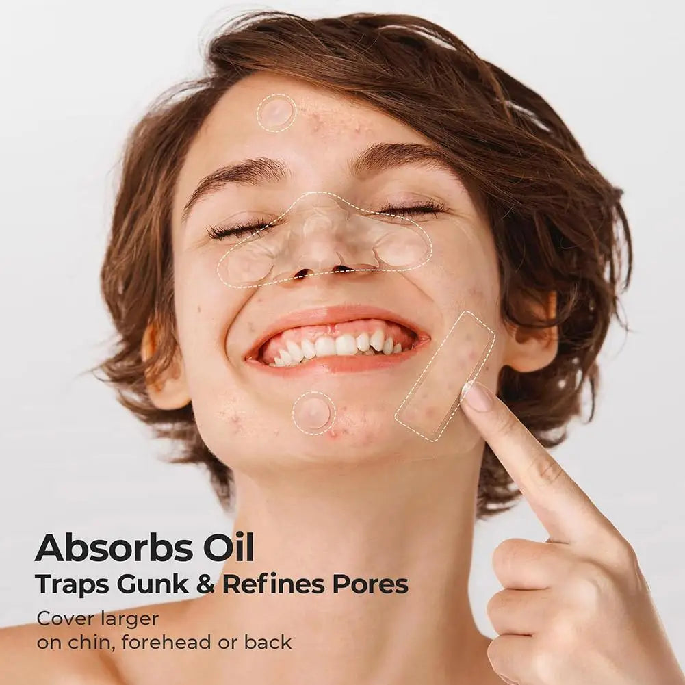 Large Pimple Patches for Face