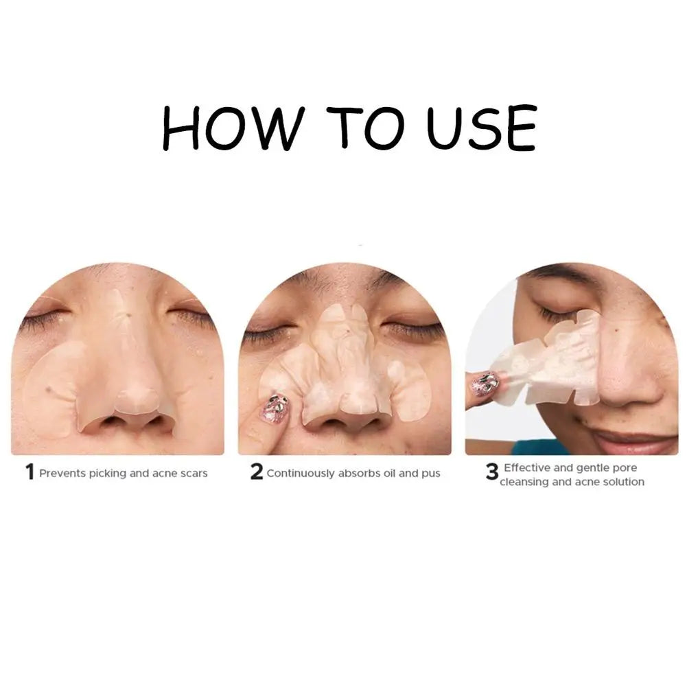 Large Pimple Patches for Face