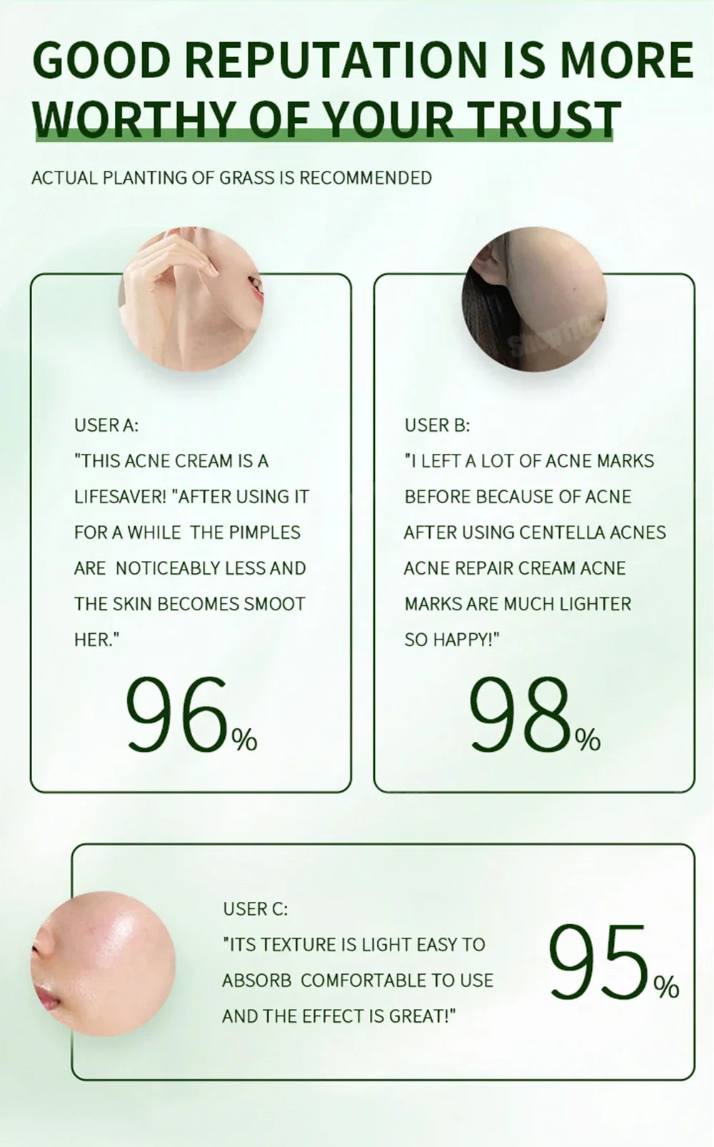 3RD Anti-Acne Essence Cream