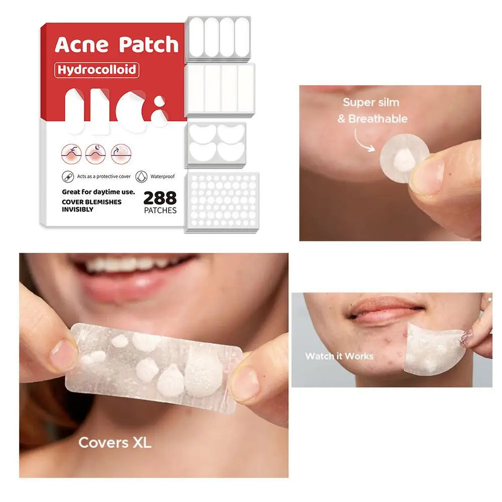Large Pimple Patches for Face