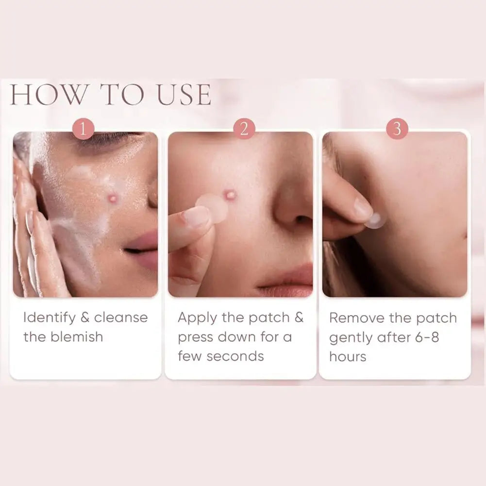 Large Pimple Patches for Face