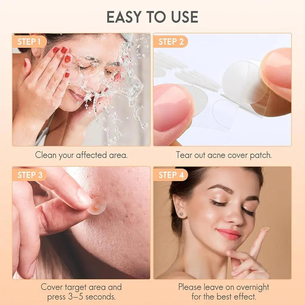 Large Pimple Patches for Face