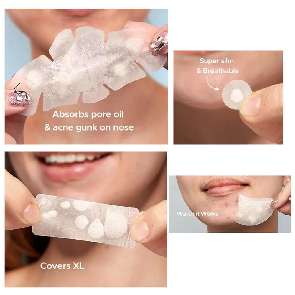 Large Pimple Patches for Face