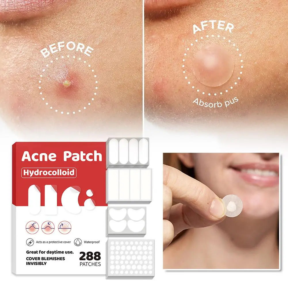 Large Pimple Patches for Face